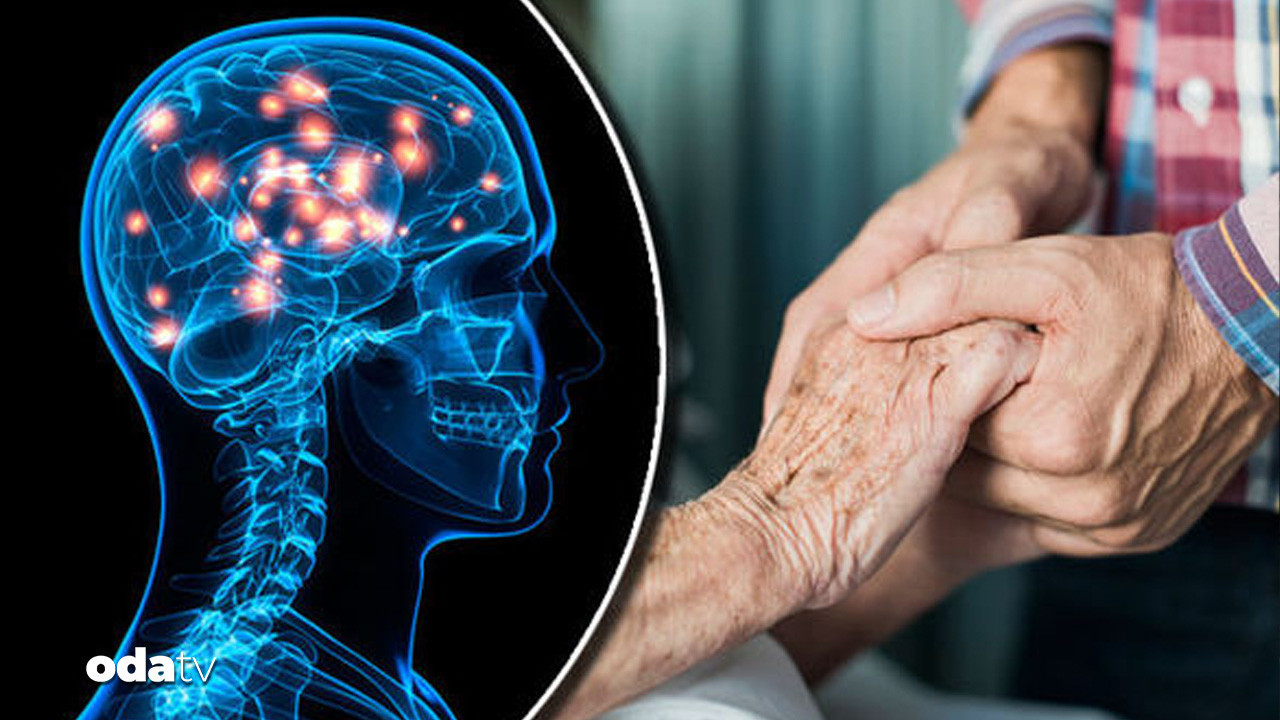 huntington hastaliginda yeni terapi yuzde 75 yavaslama fQ12dFyc